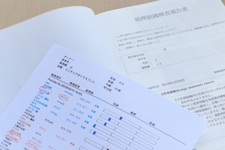 補聴器の選び方と重要性